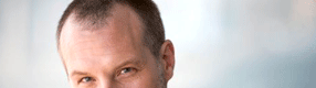 alopecia masculina