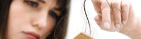 alopecia femenina