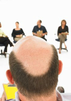 Alopecia/Calvicie