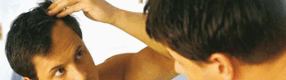 alopecia - calvicie