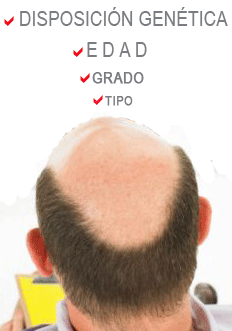 Alopecia/Calvicie